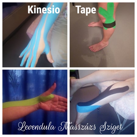 Kinesio Tape felhelyezés ára